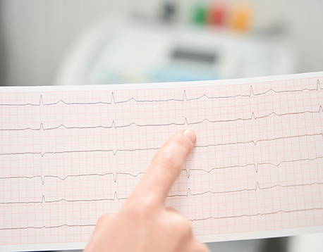 magnetna rezonanca cena