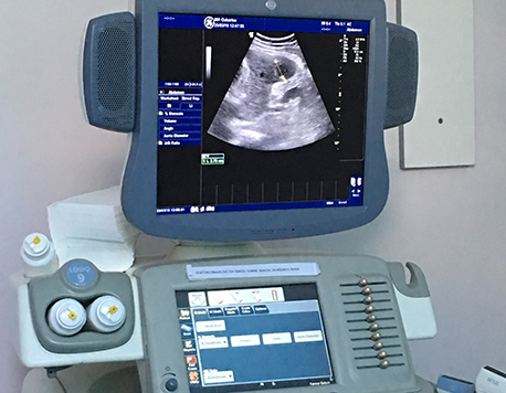 magnetna rezonanca cena